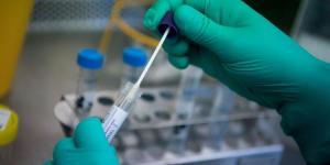 TRABZON İL SAĞLIK MÜDÜRLÜĞÜNDEN AÇIKLAMA: Coronavirüs test alım kuralları ve yerleri açıklandı