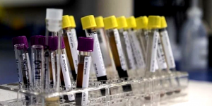 ‘GİZEMLİ HEPATİT’ VAKALARI ARTIYOR: Yeni bir küresel salgın mı başlıyor?