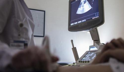 ULTRASON RANDEVUSU OCAK 2024’E VERİLDİ: Hayat meselesi, yapmayın artık!
